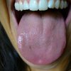 1103 Lingua